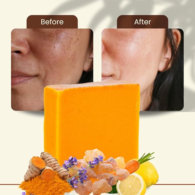 Turmeric Skin Cleansing Soap - Natural Glow Face & Body Cleanser for Acne, Dark Spots & Scars, Gentle for All Skin Types - 1 bar (4.5 oz)