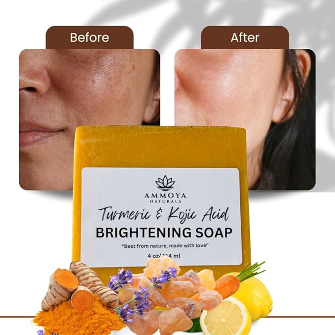 Turmeric Skin Cleansing Soap - Natural Glow Face & Body Cleanser for Acne, Dark Spots & Scars, Gentle for All Skin Types - 3 Bars (4.5 oz)