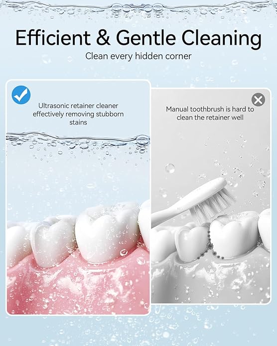 Phniti Ultrasonic Cleaner, 46kHz Ultrasonic Retainer Cleaner Professional Ultrasonic Jewelry Cleaner Machine with Timer for Dental Retainer, Mouth Guard, Watch, Ring, Diamond, White