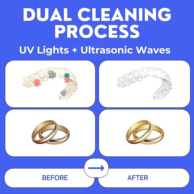 Ultrasonic Retainer Cleaner, UV Cleaner for Invisalign, Night Guard, Mouth Guard, Jewelry - Retainer Cleaning Machine