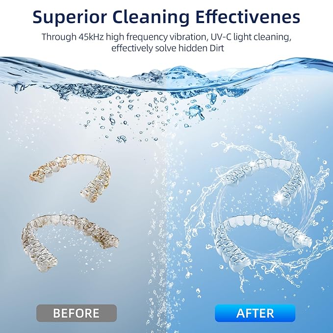 Retainer Cleaner, 45kHz Ultrasonic Retainer Cleaner Machine with 200ML Capacity & 4 Modes for Dentures, Aligners, Mouthguards, Retainers, Jewelry and Dental Cleaning Pod