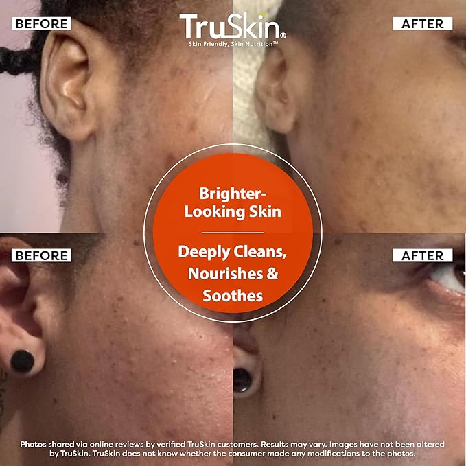 TruSkin Vitamin C Face Wash Cleanser - Brightening Facial Cleanser with Vitamins C & E, Rosehip Oil, Aloe Vera & MSM - Gently Cleanses, Refreshes & Supports Radiant Skin - 5 fl oz