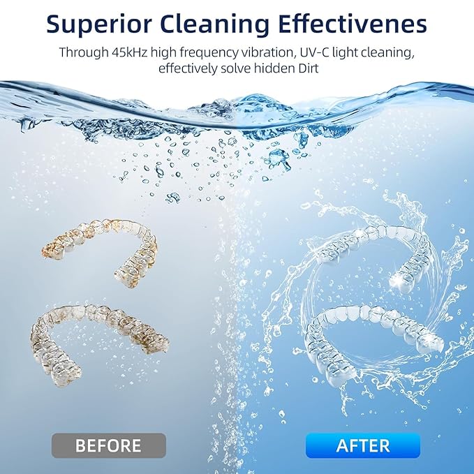 Retainer Cleaner, 45kHz Ultrasonic Retainer Cleaner Machine with 200ML Capacity & 4 Modes for Dentures, Aligners, Mouthguards, Retainers, Jewelry and Denture Appliances, White