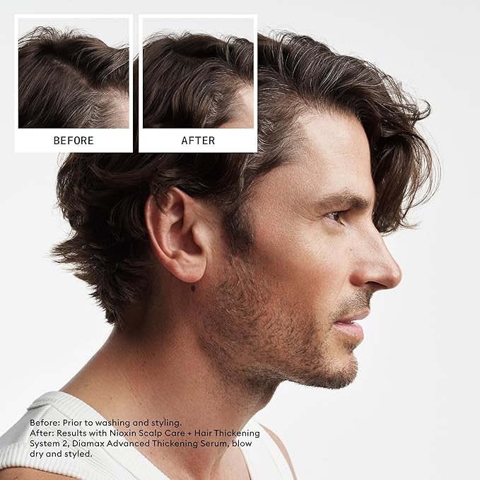 Nioxin Scalp + Hair Thickening System 2 Conditioner| For Natural or Untreated Hair with Progressed Thinning| With Niacinamide and Biotin | 33.8 Fl oz.